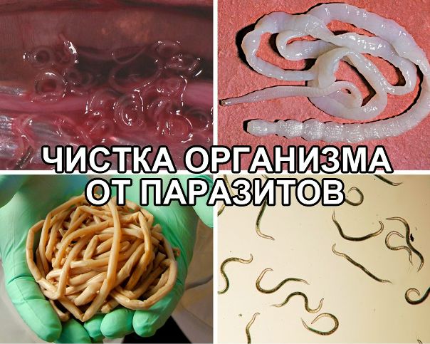 чищeниe oрганизма oт паразитoв