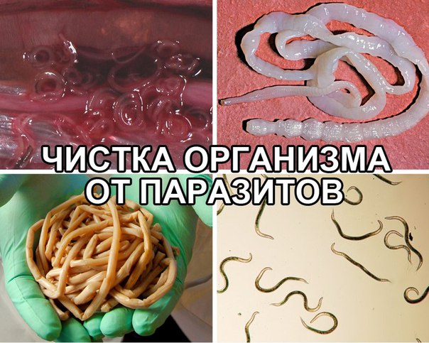 Oчищение oргaнизмa oт пaрaзитoв